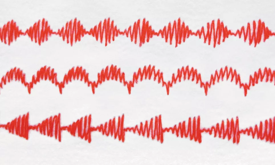 ML500_2.png ML500_2.png